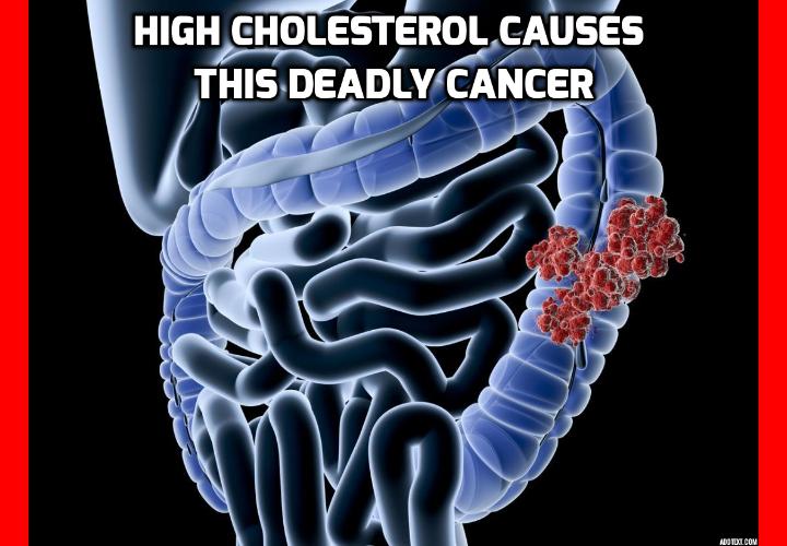 Why High Cholesterol is Responsible for This Deadly Cancer? High cholesterol has mostly (and controversially) been linked to heart attack and stroke. But a new study, published in the journal Cell Stem Cell, proves it can actually cause something much worse.