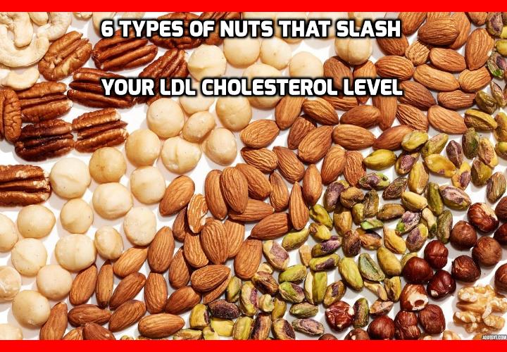 6 Types of Nuts That Absolutely Down LDL Cholesterol Level - Nuts contain several nutrients that make them particularly heart and cholesterol healthy. The most important of these are vitamin E, monounsaturated oil, and fiber. But not all nuts are created equals. In today’s post we’ll list the 6 most heart healthy nuts and explain why they’re so good for you and can help to down LDL cholesterol level.
