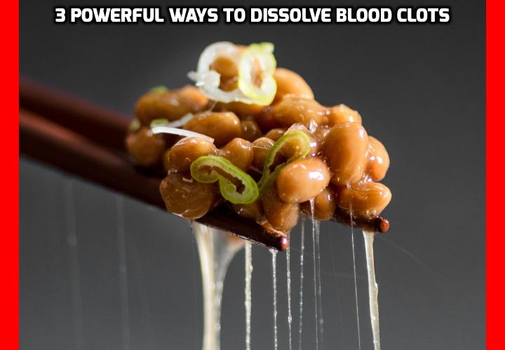 3 Powerful Ways to Dissolve Blood Clots - There is an abundance of prescription blood thinner drugs available meant to dissolve blood clots and prevent stroke and heart attack. But despite the attracting advertising, the fact is that the side effects of these drugs are extremely dangerous. Nature has, however, held a safe, inexpensive, and natural key to clot-busting all along. Here are 3 powerful ways you can use to dissolve blood clots.