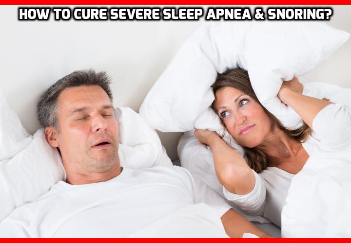 what-is-the-best-way-to-cure-severe-sleep-apnea-anti-aging-beauty-health-personal-care