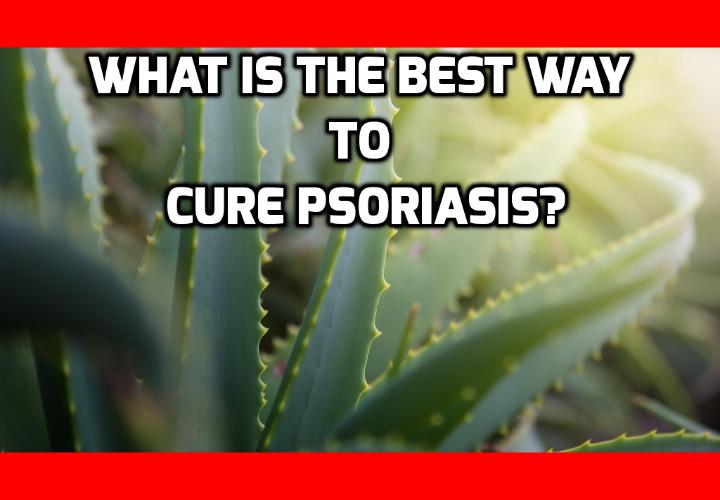 What is the Best Way to Cure Psoriasis? Thankfully, for those who suffer from this ailment, there is a proven treatment that has been used for the past four millennia as a sure-fire treatment for all skin problems, This miracle way to cure psoriasis, this magic balm that has been passed hand to hand for countless generations, this virtually skin problem cure all that is the is the best home remedy around is none other than Aloe Vera. 