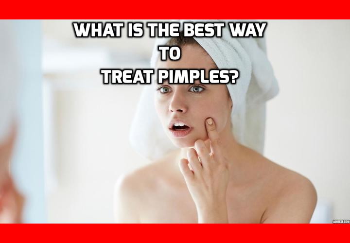 What is the Best Way to Treat Pimples? How to treat pimples if you are over 20? Is Benzoyl Peroxide the best way to treat pimples? Is there any alternative way to treat pimples?