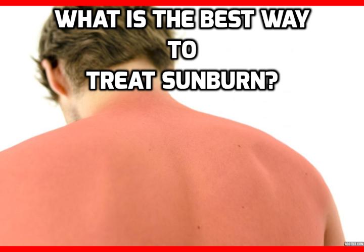 What is the Best Way to Treat Sunburn? While there are many different traditional home remedies out there for mild to moderate sunburns, one of the most tried and true remedies to treat sunburn, come from one of this countries favourite indoor plants: The Aloe Vera plant. Read on to find out more.
