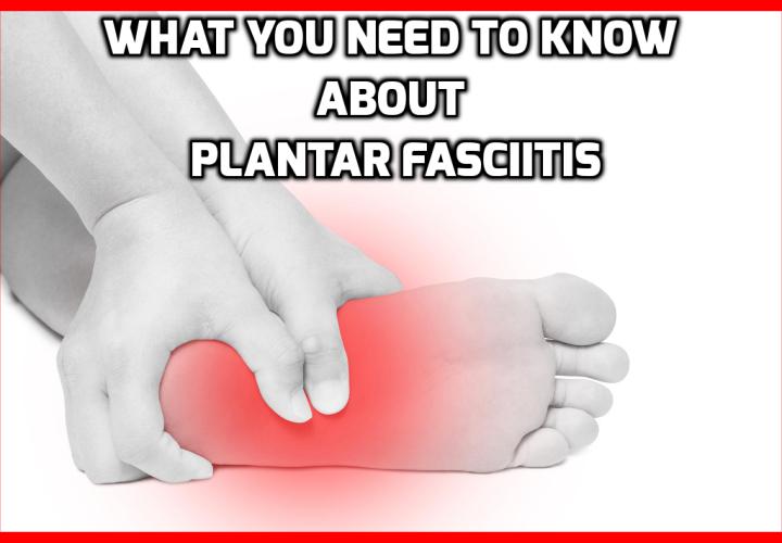 What You Need to Know About Plantar Fasciitis - What Is Plantar Fasciitis? Plantar Fasciitis is an injury sustained as the result of repetitive stress placed on the bottom of the foot. More specifically, its damage sustained on the fascia—a thin layer of fibrous tissue that protects other tissues within your feet. Many people develop Plantar Fasciitis from long periods of standing, running, or performing various load-bearing activities.