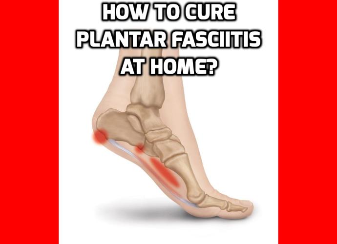 What is the Best Way to Cure Plantar Fasciitis at Home? Have you been suffering from the pain of Plantar Fasciitis? Do you wake up in the morning with aching pain in your heel? Has your Plantar Fasciitis robbed you of your quality of life? Are you looking for ways to cure plantar fasciitis?