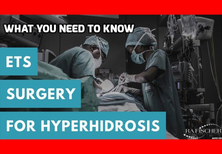 What You Need to Know About Surgical Cure for Hyperhidrosis - A lot of people suffer from excessive sweating and when nothing seems to be working for them a lot of them consider surgery as an option. But before surgery can really be considered as fool-proof option, the pros and cons of the surgical cure for hyperhidrosis should be considered. 