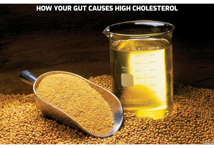 What is the Best Way to Prevent Cholesterol Buildup in Arteries? Most nutritional experts advise that in order to prevent cholesterol buildup in arteries, you should cut down the amount of cholesterol and fat in your food. The theory behind this assertion is that cholesterol will go from the food into your bloodstream, where it adds to the blood cholesterol and packs up in your heart arteries. But this is not what happens at all. In fact, there is a little process that is occurring in your guts that may be the main reason for your high cholesterol level.