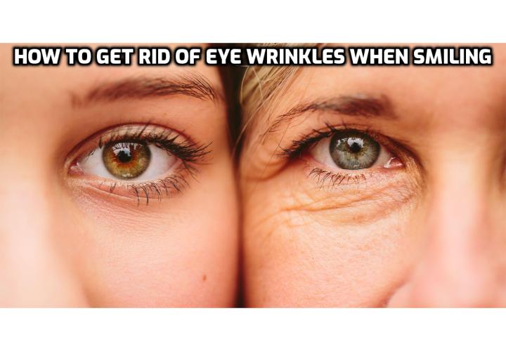 smile wrinkles around eyes