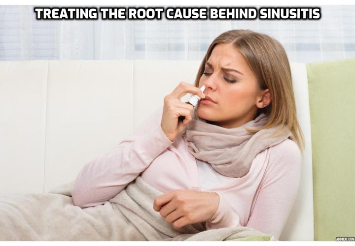 What is the Best Way for Treating the Root Cause behind Sinusitis?  Treating the Root Cause behind Sinusitis - A sinus infection, even if acute, causes severe pain. The infection is a result of inflammation of cavities present near the nose, known as sinuses. This sinus infection, more popularly known as sinusitis, can either be acute or chronic. A chronic infection lasts for a longer duration than an acute one. The home treatments for sinus infection are more suitable for acute infections. 