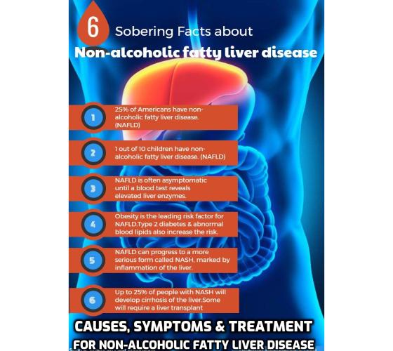 What You Need to Know about Non-Alcoholic Fatty Liver Disease -  Non-alcoholic fatty liver disease (NAFLD) has numerous causes. Like alcoholic fatty liver disease, non-alcoholic fatty liver disease may be reversed if caught in the early stages. Dietary changes and discontinuing all alcohol will be what it takes to start the fatty liver disease reversal.