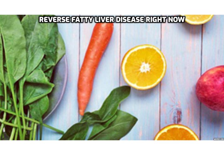 What is the Best Way to Reverse Fatty Liver Disease Right Now? What is fatty liver disease? What are the symptoms of fatty liver disease? What can cause fatty liver disease?  Want to reverse fatty liver disease right now? Read on to find out more.