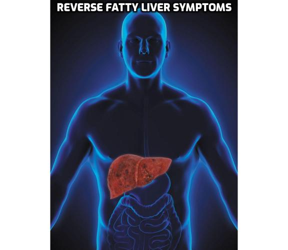 What is the Best Way to Reverse Fatty Liver Symptoms? There's not one medication for everyone to reverse fatty liver symptoms. Instead, the answer may be medication to lose weight, metformin to bring down the blood sugar level, or statin drugs to lower cholesterol and triglycerides.