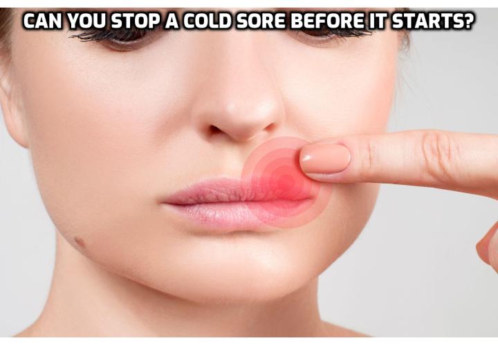 Fighting Cold Sores – Can You Stop a Cold Sore Before It Starts?  Fighting Cold Sores - A cold sore can be very embarrassing because it affects the most visible parts of the body such as lips, mouth, nostrils, eye lids, etc. Many people opt for costly medications and ointments which may or may not cure the person temporarily but there are cheap and effective everyday household items which will provide significant help in curing the disease. Toothpaste is one such item which if applied accordingly will give a cooling and numbing effect to the person.