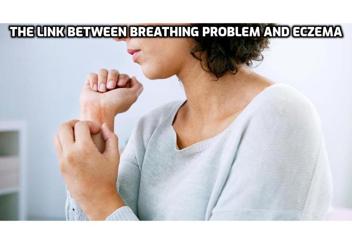 Breathing As a Powerful Eczema Treatment - Sometimes treatments come from the unlikeliest of sources. A powerful eczema treatment which we, most probably, have never heard before is an exercise that aims to bring our breathing levels to normal. Read on to find out more.