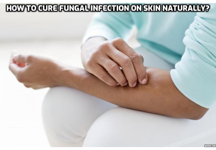 skin-fungus-treatment-how-to-cure-fungal-infection-on-skin-naturally