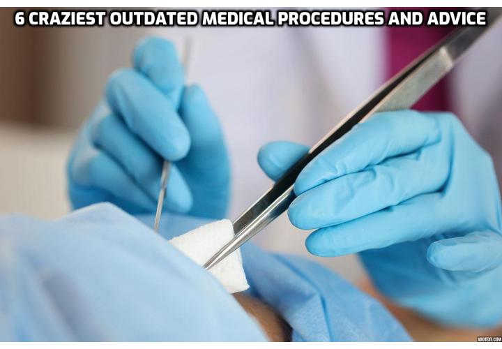6 Craziest Outdated Medical Procedures and Advice Here - Here are some of the craziest outdated medical procedures, including some that are still in use today, especially in relation to back pain, pain management and weight loss.