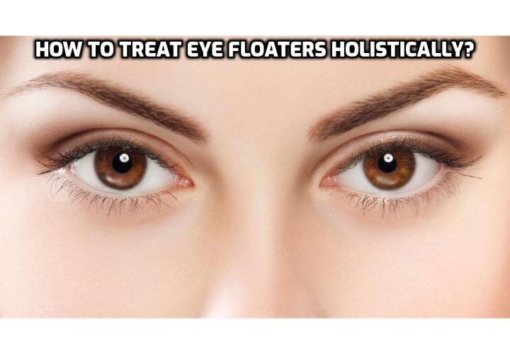 Revealing Here – How to Treat Eye Floaters Holistically? Treat Eye Floaters Holistically - This involves nutritional and lifestyle modification together with a natural supplementation regimen. Read on here to find out more.