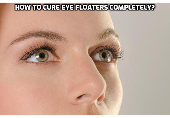 Eye Floaters Treatment – How to Cure Eye Floaters Completely? Surgery is the only type of medical eye floaters treatment currently available. The most common type of surgery for eye floaters removal is vitrectomy, which involves removing the vitreous humor (the gel-like solution in the eye) together with any debris (the 'floaters') and replacing it with a saltwater solution. The other type of surgery for eye floaters treatment is YAG laser removal. This procedure uses a specialized laser to burn off the individual floaters.