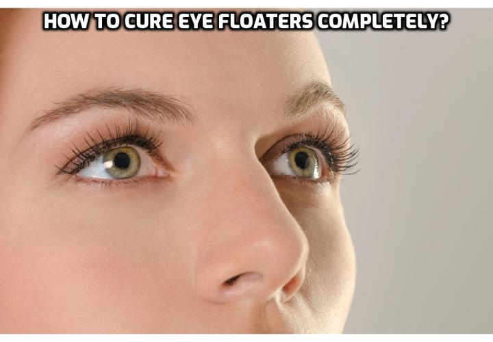 Eye Floaters Treatment - How to Cure Eye Floaters Completely?