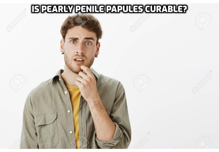 Pearly Penile Papules Treatment and Management – Is Pearly Penile Papules Curable? Pearly Penile Papules Treatment and Management – If you want to have a normal penis, you should stay away from picking your pearly penile papules, cause this condition will go away at a certain point or may be treated so that it will not appear any more, but scars and infections are much more difficult to deal with and you may even remain with those marks on your penis all your life. 