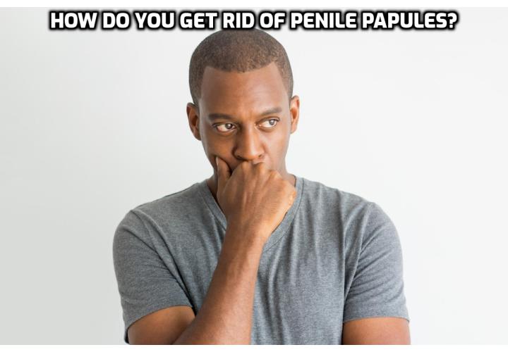 Pearly Penile Papules Removal – How Do You Get Rid of Penile Papules?  Pearly Penile Papules Removal – Stop worrying about pearly penile papules right now. Find out the safest and most effective way by means of which you can get rid of this condition. Read on here to learn how you can forget about all the embarrassing situations in which pearly penile papules may put you and how you can enjoy your life as a normal man. 