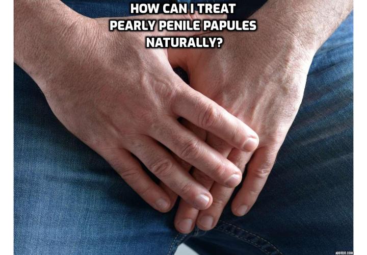 Pearly papules removal easy and quickly