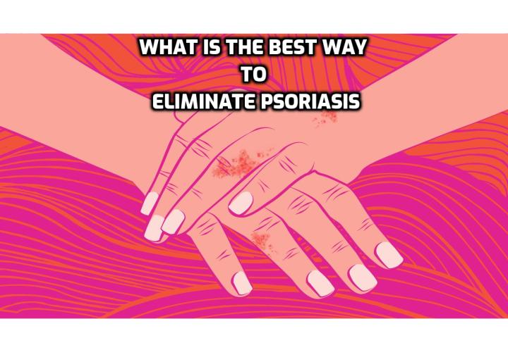 What is the Best Way to Eliminate Psoriasis for Good? Eliminate Psoriasis for Good - Most people think of psoriasis as annoying skin disease, nothing worse than that, and certainly not something that could be fatal. But a new study reveals psoriasis can lay the groundwork for something that might kill you.