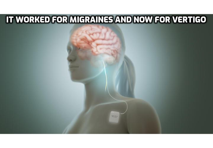 Cure Vertigo Within a Week – What Cures Vertigo Fast? Cure Vertigo Within a Week – Researchers at the Amsterdam University Medical Center have discovered a new treatment for vertigo that not only eases symptoms; it also prevents episodes. You can do this treatment at home, without a doctor or drugs. And it causes no side effects. Read on to find out more.