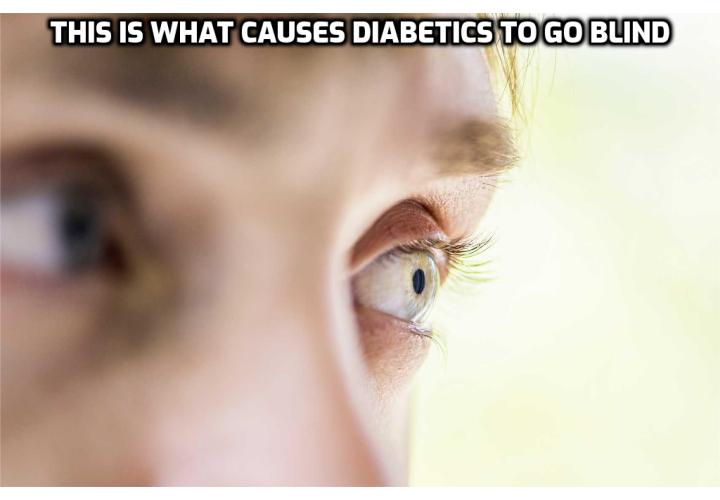 Reverse Your Diabetes Permanently Before the Damage Is Done – Have you ever wondered why diabetics need limb amputations more than the average person? Have you ever wondered why blindness, heart attacks and strokes are more prevalent in diabetics? Read on to find out more.
