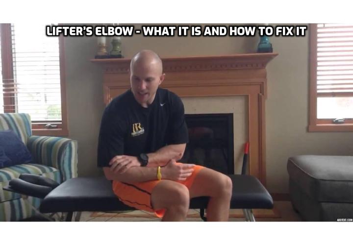 LIFTER’S ELBOW - WHAT IT IS AND HOW TO FIX IT. What causes elbow pain? What helps with elbow pain from lifting? How to strengthen your elbows?