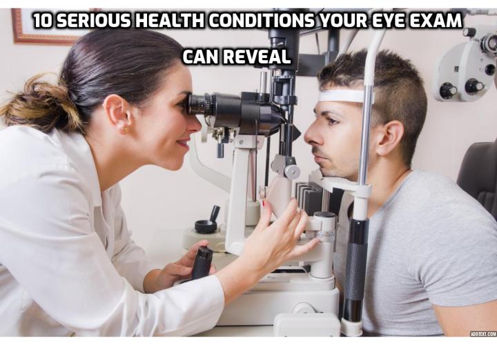 Wellbeing Tips and Tricks – How to Improve Your Health and Wellbeing? An eye examination by a qualified and informed eye specialist can reveal as much (and sometimes more) about your health as your general health checkup. For 10 more reasons not to skip that regular eye exam, check out the 10 health conditions that your eye specialist can detect very early on