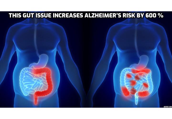 What is the Best Way to Prevent and Even Lower Alzheimer’s Risk? The way to do is to improve your gut health, keep your cholesterol, blood sugar and blood pressure under control.