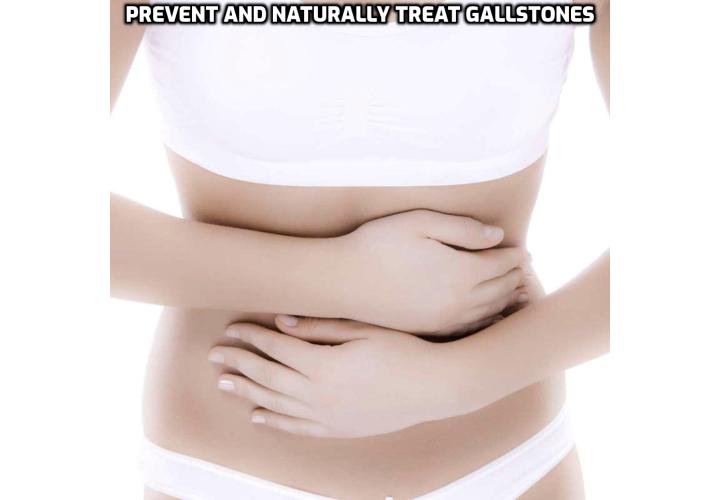 Most people don’t realize that a gallstone diet can prevent and naturally treat gallstones. Your diet can be a type of holistic treatment that can assist your body to flush gallstones. Too often, though our diets are just the opposite of a good gallstone diet. So what does a natural health gallstone diet consist of? Read on to find out more.