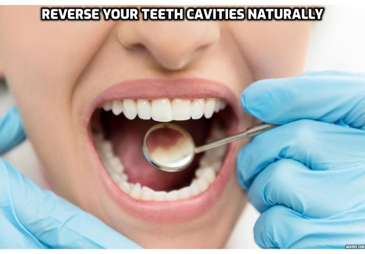 Do you know you can reverse your teeth cavities naturally? To find out more, check out The ‘Dentist Be Damned!’ program is a 80-pages eBook protocol that teaches readers everything they need to know about reversing teeth cavities and gum diseases. It also teaches you what you can do to prevent them from ever happening again.