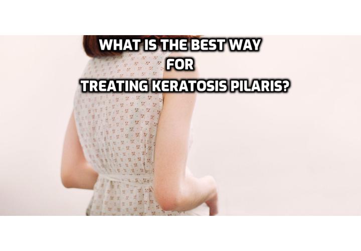 What is the Best Way for Treating Keratosis Pilaris? If you are suffering from keratosis pilaris or a related skin condition, see your doctor or a dermatologist to discuss potential treatments like using a rich moisturizer daily or installing a humidifier in your home. He or she may also recommend a corticosteroid cream to reduce redness and roughness of your skin.