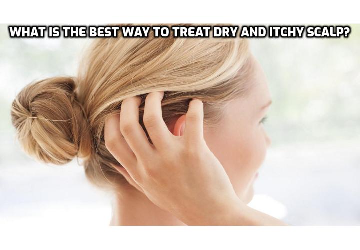 What is the Best Way to Treat Dry and Itchy Scalp? Are you looking for ways to treat dry and itchy scalp? If you do, read on to find out how Mia Wadsworth can help you by providing powerful home remedies and dry itchy scalp treatments so that you can regain confidence and have beautiful shiny hair.