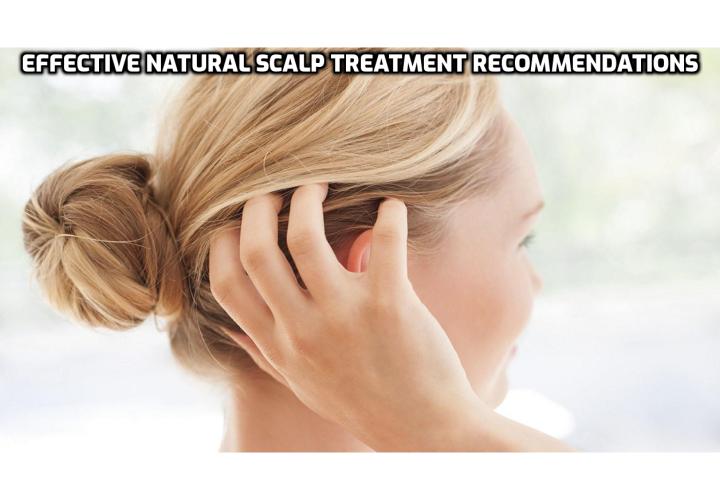 Natural Scalp Treatment - Scalp treatments using natural oils not only help to soothe the symptoms of uncomfortable conditions in minutes, but they can also help to heal, prevent hair loss and restore healthy hair and balance. Oils like lavender and neem are fantastic not only for their antibacterial and antifungal properties, but they also help to stop itching and soothe irritation - making them great ingredients in a scalp treatment remedy.