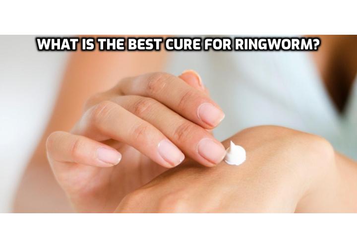 What is the Best Cure for Ringworm? There are many cures, treatments and home remedies available at your disposal. Listed here are 3 steps you need to take to cure ringworm in 3 days or less.