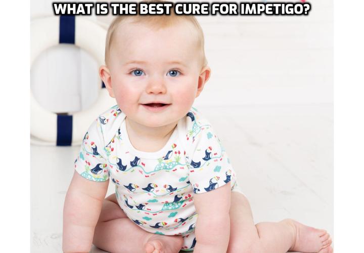 The best and most effective cure for Impetigo is through the use of natural Impetigo remedies and treatments.  It requires you to build up the good bacteria in your body, strengthen your immune system and to heal the blisters and sores in a natural and safe way.