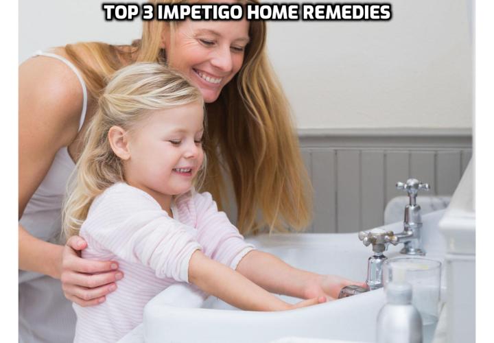 Here is a list of some useful Impetigo home remedies that you can begin using right away to cure Impetigo in days. Read on here to find out more.