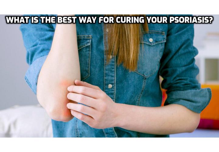 Are you looking for ways for curing your psoriasis? If you do, read on to learn about Julissa Clay’s Psoriasis Program whom she offers her tips and techniques which she used while struggling with psoriasis.