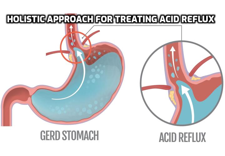 You can effectively manage acid reflux using natural health remedies. A balanced diet and regular exercise are two natural remedies that help not only in curbing the pain and symptoms of acid reflux, but also in dealing with the underlying causes of the condition.