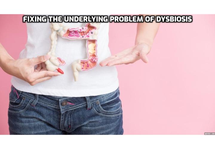 Healing Gut Dysbiosis – The most effective way to clear dysbiosis with long term success is by using a holistic approach to healing leaky gut and attack it from all angles.