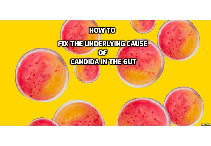 Leaky Gut and Candida – Are Leaky Gut and Candida somehow related and which one causes the other? The truth is that the two are oftentimes related and go hand in hand but they are two entirely different issues to begin with. And either one can easily lead to the other.