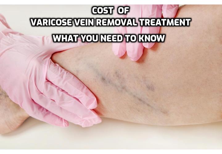 Varicose Vein Removal Treatment - The three treatments that are commonly offered are Endovenous Laser Treatment (EVLT), Sclerotherapy and Phlebectomy. When choosing somewhere to have a procedure of this type, it will benefit you to get recommendations, check that the premises is licensed probably and that the people performing the procedure are properly qualified to do the procedure that you are paying for. 