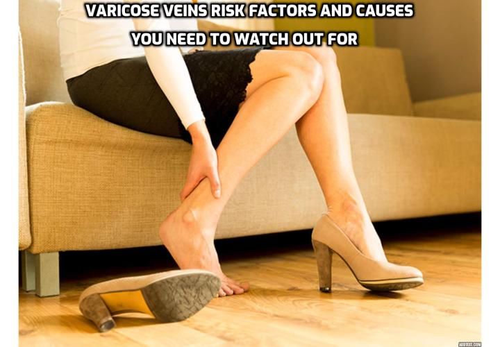 Here are the 5 varicose veins risk factors and causes you need to know to prevent varicose veins from developing. They are gender, pregnancy, occupation, sedentary lifestyle and genetic factor.