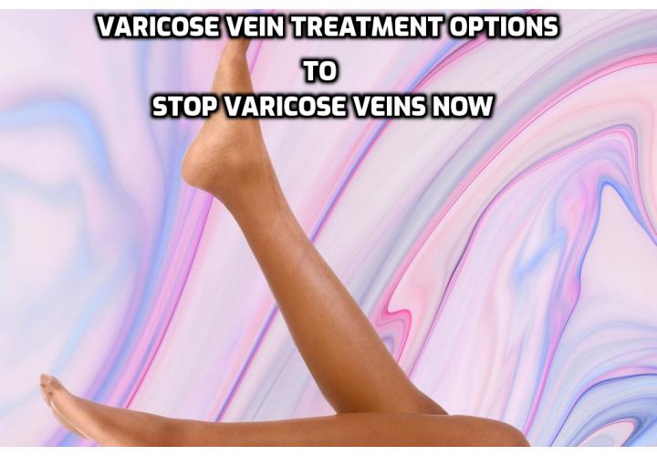 If you are a varicose vein sufferer, there is a bewildering array of varicose vein treatment options. In the UK, some surgeries and treatments can be funded by the NHS, however as this is considered to be more of a cosmetic problem rather than a serious medical one, it is often dependent on what can be dealt with under the terms of any medical insurance that you hold.