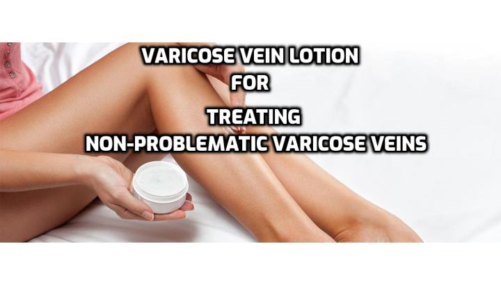 If you happen to be a varicose vein sufferer, no doubt you will be keen to find out if there are any useful non-surgical, non-invasive ways of treating the condition, and using a varicose vein lotion for treating non-problematic varicose veins is a good place to start.