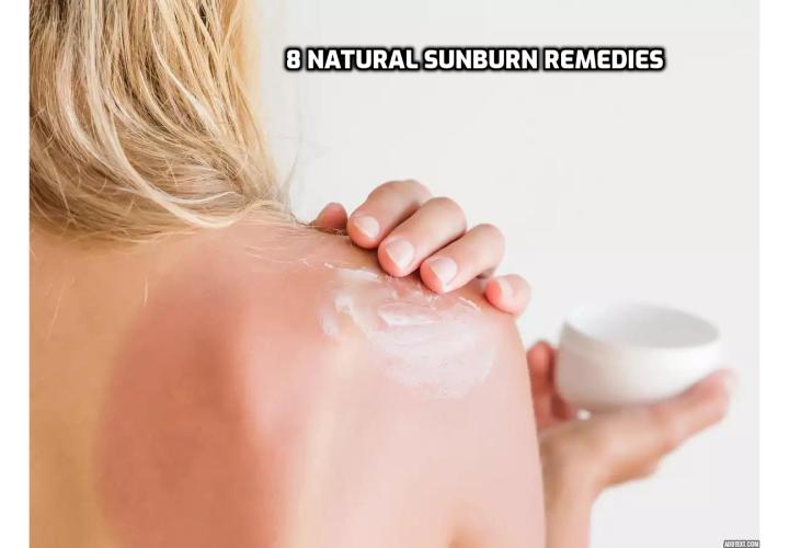 Sunshine can be your best friend or your worst enemy. Getting your dose of vitamin D is crucial, but if you’ve gotten a little more than your fill, these 8 natural sunburn remedies can help.