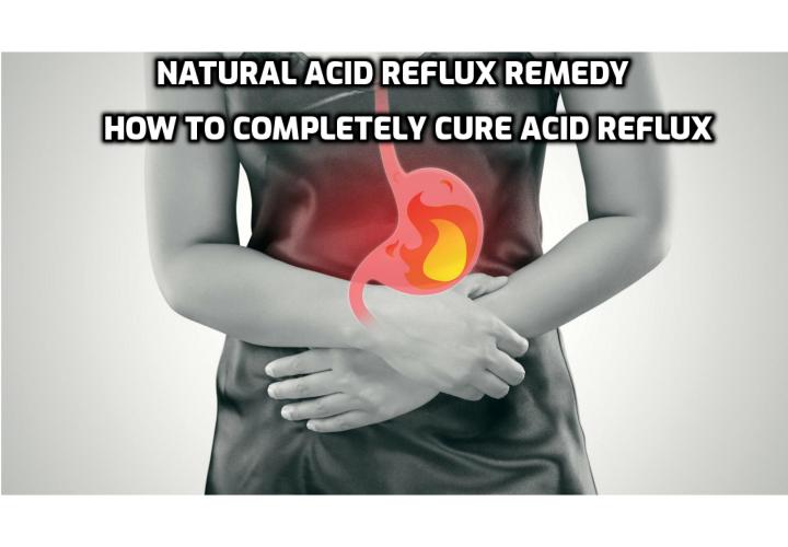 Natural Acid Reflux Remedy – How to Completely Cure Acid Reflux. Read on to learn more about Scott Davis’ Acid Reflux Solution. This program helps you to cure your heartburn and acid reflux by using natural remedies to quickly heal your stomach without dangerous medicine or risky surgeries.